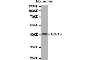 Western Blotting (WB) image for anti-Alcohol Dehydrogenase 1B (Class I), beta Polypeptide (ADH1B) (AA 206-375) antibody (ABIN6218524) (ADH1B antibody  (AA 206-375))