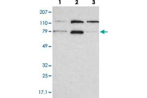 Western blot analysis of lane 1: RT-4, lane 2: EFO-21 and lane 3: A-431 cell lysates using PNN polyclonal antibody .