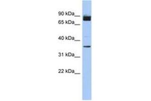 Image no. 1 for anti-Coiled-Coil Serine-Rich Protein 1 (CCSER1) (AA 71-120) antibody (ABIN6743951)