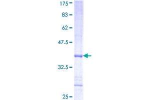 PHKA2 Protein (AA 428-521) (GST tag)