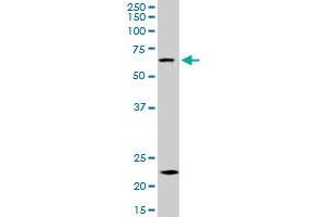 Western Blotting (WB) image for anti-Zinc Finger Protein 306 (ZKSCAN3) (AA 1-539) antibody (ABIN961326) (ZKSCAN3 antibody  (AA 1-539))