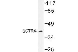 Image no. 1 for anti-Somatostatin Receptor 4 (SSTR4) antibody (ABIN317867) (SSTR4 antibody)