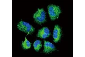 Confocal immunofluorescent analysis of CHAT antibody with NCI-H460 cells followed by Alexa Fluor 488-conjugated goat anti-rabbit lgG (green). (Choline Acetyltransferase antibody  (AA 98-128))