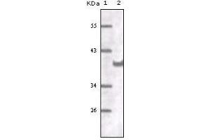 Western blot analysis using CD31 mouse mAb against truncated CD31 recombinant protein.