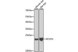 Recoverin antibody