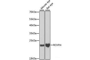 Western blot analysis of extracts of various cell lines using RCVRN Polyclonal Antibody at dilution of 1:1000. (Recoverin antibody)