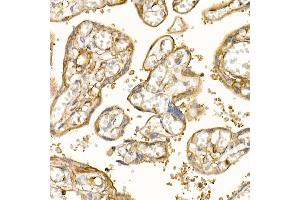 Immunohistochemistry (IHC) image for anti-Mesencephalic Astrocyte-Derived Neurotrophic Factor (MANF) (AA 25-182) antibody (ABIN6143461)