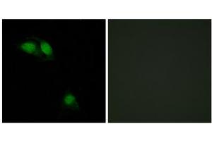 Immunofluorescence analysis of HeLa cells, using IRS-1 (Phospho-Ser312) antibody. (IRS1 antibody  (pSer312))