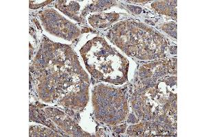 IHC analysis of GRB10 using anti-GRB10 antibody (ABIN7599160).