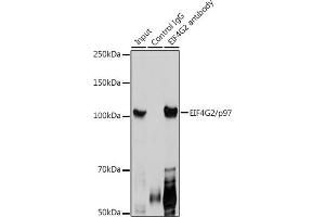 Immunoprecipitation analysis of 300 μg extracts of HeLa cells using 3 μg EIF4G2/p97 antibody (ABIN3016940, ABIN3016941, ABIN3016942 and ABIN6219894). (EIF4G2 antibody  (AA 750-850))