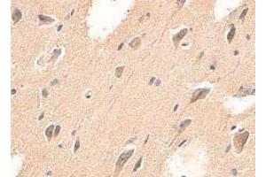 Immunohistochemical staining of formalin-fixed paraffin-embedded human brain tissue with ADAMTS4 polyclonal antibody  at 1 : 200 dilution.