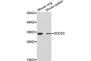 Western blot analysis of extracts of various cell lines, using SOCS3 antibody (ABIN2650956) at 1:3000 dilution. (SOCS3 antibody)