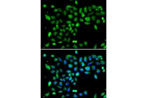 Immunofluorescence analysis of U2OS cells using DYRK2 antibody (ABIN5974219). (DYRK2 antibody)
