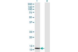Western Blot analysis of CRABP2 expression in transfected 293T cell line by CRABP2 monoclonal antibody (M01), clone 4F2. (CRABP2 antibody  (AA 1-138))