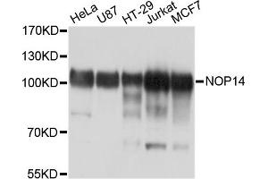 Western blot analysis of extracts of various cell lines, using NOP14 antibody. (Nop14 antibody)