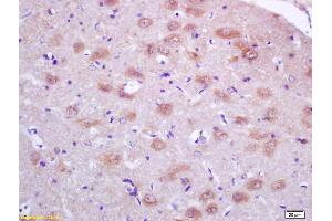 Formalin-fixed and paraffin embedded rat brain labeled with Anti-PRDX1 Polyclonal Antibody, Unconjugated (ABIN750478) at 1:200, followed by conjugation to the secondary antibody and DAB staining (Peroxiredoxin 1 antibody  (AA 1-100))