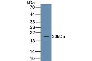 Detection of Recombinant GLUT1, Human using Polyclonal Antibody to Glucose Transporter 1 (GLUT1)