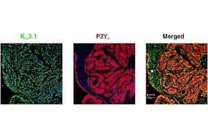 Multiplex staining of KCa3.