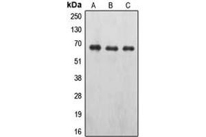 Western blot analysis of EPO Receptor (pY426) expression in A498 (A), MCF7 pervanadate-treated (B), NIH3T3 (C) whole cell lysates. (EPOR antibody  (pTyr426))