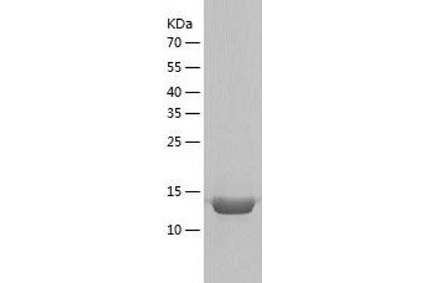 PDE6D Protein (AA 1-150) (His tag)