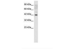 Image no. 1 for anti-Zfp-1 (AA 122-171) antibody (ABIN202319) (Zfp-1 antibody  (AA 122-171))