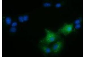 Anti-FAM84B mouse monoclonal antibody (ABIN2453030) immunofluorescent staining of COS7 cells transiently transfected by pCMV6-ENTRY FAM84B (RC207996). (FAM84B antibody)