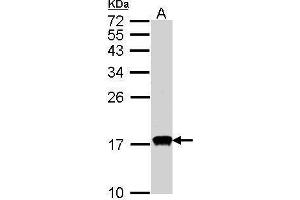 WB Image Sample(30 ug whole cell lysate) A:HeLa S3, 15% SDS PAGE antibody diluted at 1:1000 (CDA antibody)