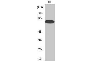 Western Blotting (WB) image for anti-Nuclear Factor-kB p65 (NFkBP65) (pThr254) antibody (ABIN3182091) (NF-kB p65 antibody  (pThr254))