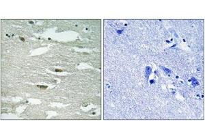 Immunohistochemical analysis of paraffin-embedded human brain tissue using ILK (Phospho-Ser246) antibody (left)or the same antibody preincubated with blocking peptide (right). (ILK antibody  (pSer246))