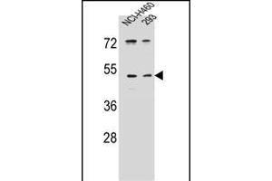 PRSS55 anticorps  (C-Term)