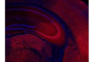 Immunohistochemistry (IHC) image for anti-Ubiquitin Carboxyl-terminal Esterase L1 (Ubiquitin Thiolesterase) (UCHL1) (AA 6-223) antibody (ABIN1742479) (UCHL1 antibody  (AA 6-223))