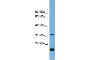 WB Suggested Anti-CTDSP2  Antibody Titration: 0. (CTDSP2 antibody  (Middle Region))