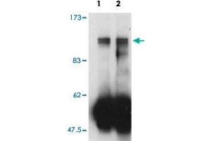 Western blot analysis of immunoprecipitates from mouse cell line lysates using Farp2 polyclonal antibody.