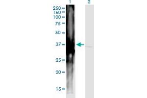 Western Blot analysis of ART4 expression in transfected 293T cell line by ART4 monoclonal antibody (M01), clone 2F8. (ART4 antibody  (AA 61-160))