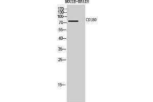 Western Blotting (WB) image for anti-CD180 Molecule (CD180) (Internal Region) antibody (ABIN3181467)