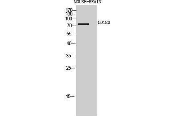 CD180 Antikörper  (Internal Region)