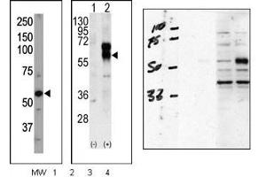 Image no. 2 for anti-Activin A Receptor Type II-Like 1 (ACVRL1) (N-Term) antibody (ABIN360124) (ACVRL1 antibody  (N-Term))
