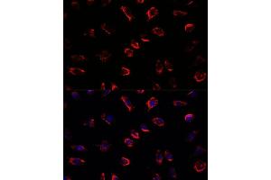 Immunofluorescence analysis of L929 cells using IL11 antibody (ABIN6128128, ABIN6142292, ABIN6142293 and ABIN6219040) at dilution of 1:100. (IL-11 antibody  (AA 22-199))