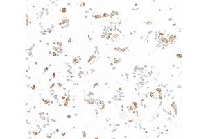 Immunocytochemistry (ICC) image for anti-Nuclear Factor-kB p65 (NFkBP65) (C-Term) antibody (ABIN7795799) (Recombinant NF-kB p65 antibody  (C-Term))