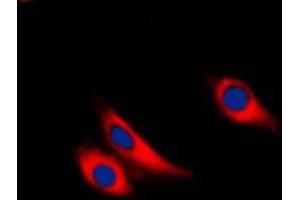 Immunofluorescent analysis of Galectin 9 staining in THP1 cells. (Galectin 9 antibody  (Center))