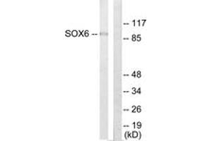 Western Blotting (WB) image for anti-SRY (Sex Determining Region Y)-Box 6 (SOX6) (AA 10-59) antibody (ABIN2889463) (SOX6 antibody  (AA 10-59))