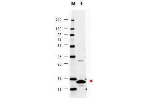 Image no. 1 for anti-Colony Stimulating Factor 2 (Granulocyte-Macrophage) (CSF2) antibody (ABIN1100980) (GM-CSF antibody)