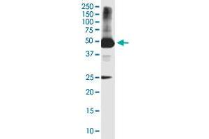 HYKK monoclonal antibody (M01), clone 4F2. (AGPHD1 antibody  (AA 1-172))