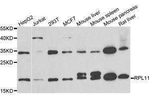 Western blot analysis of extracts of various cell lines, using RPL11 antibody (ABIN5973808) at 1/1000 dilution. (RPL11 antibody)