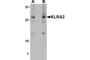Western Blotting (WB) image for anti-Killer Cell Lectin-Like Receptor, Subfamily A, Member 2 (Klra2) (C-Term) antibody (ABIN1030472) (Klra2 antibody  (C-Term))