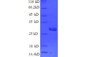 SDS-PAGE (SDS) image for Epiplakin 1 (EPPK1) (AA 1-225), (partial) protein (His tag) (ABIN5709481) (Epiplakin 1 Protein (EPPK1) (AA 1-225, partial) (His tag))