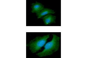 ICC/IF analysis of HTATIP2 in A549 cells line, stained with DAPI (Blue) for nucleus staining and monoclonal anti-human HTATIP2 antibody (1:100) with goat anti-mouse IgG-Alexa fluor 488 conjugate (Green). (HIV-1 Tat Interactive Protein 2, 30kDa (HTATIP2) (AA 1-242) antibody)
