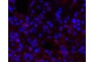 Immunofluorescence analysis of Rat lung tissue using BRCA1 Polyclonal Antibody at dilution of 1:200. (BRCA1 antibody)