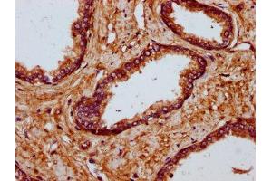 IHC image of ABIN7174945 diluted at 1:700 and staining in paraffin-embedded human prostate tissue performed on a Leica BondTM system. (MYO1E antibody  (AA 62-189))