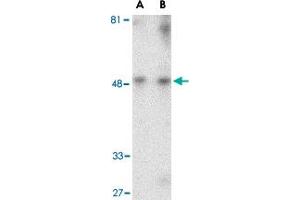 Western blot analysis of HAVCR1 in human uterus tissue lysate with HAVCR1 polyclonal antibody  at (A) 1 and (B) 2 ug/mL . (HAVCR1 antibody  (Internal Region))